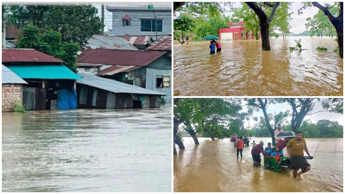 চট্টগ্রামে বন্যার পর দুর্ভোগ অব্যাহত, পানিবাহিত রোগের শঙ্কা