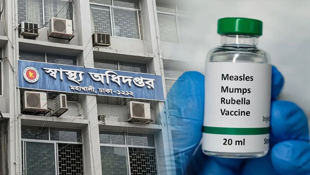 হামে আক্রান্ত হয়ে আরও ৩ শিশুর মৃত্যু, ৯৯৬ জন হাসপাতালে ভর্তি