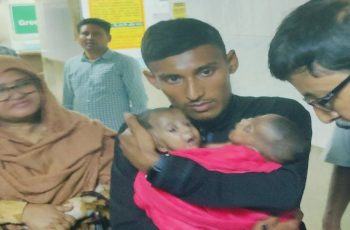 সরকারের চিকিৎসার দায়িত্ব নিল কুষ্টিয়ার জোড়া লাগা শিশুদের