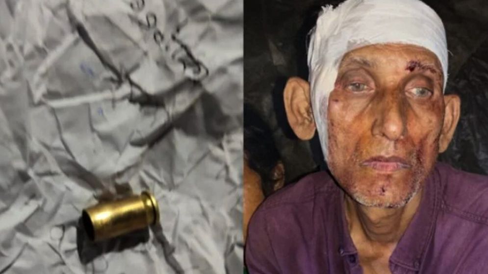 মানিকগঞ্জে স্বর্ণ-রুপা ছিনতাই, আহত ৩ জন