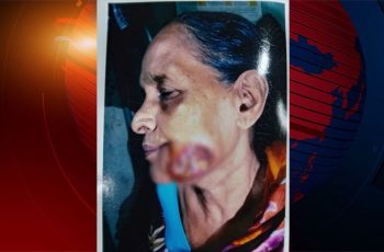অর্থের অভাবে থমকে আছে ক্যান্সার আক্রান্ত হেনারার চিকিৎসা