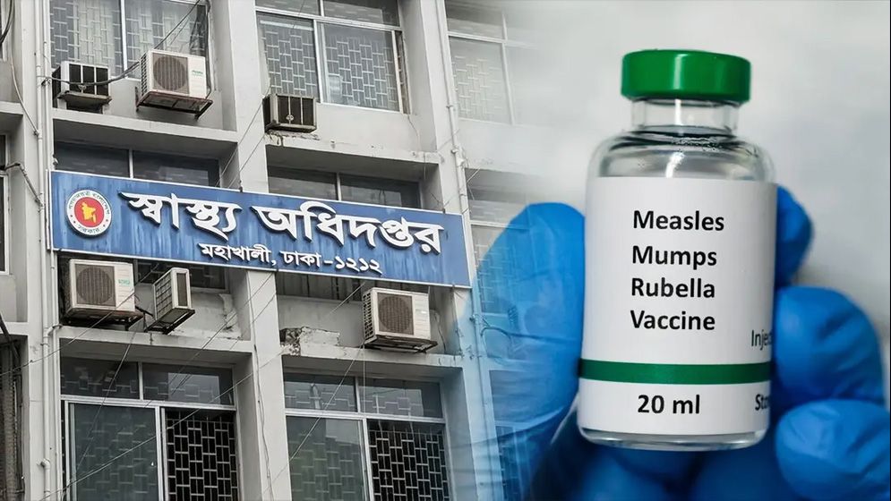 হাম উপসর্গে আরও একজনের মৃত্যু, আক্রান্ত ১ হাজার ১০