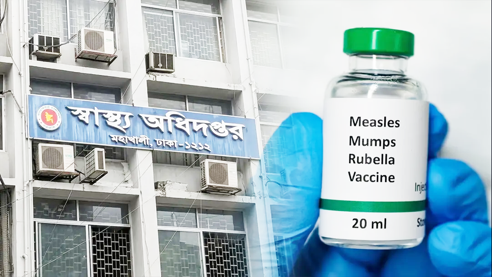 হামের উপসর্গে ২৪ ঘণ্টায় ২ শিশুর মৃত্যু, আক্রান্ত ১,৩১৬